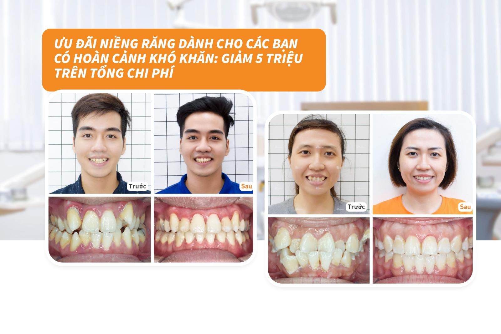 Ưu đãi niềng răng dành cho các bạn có hoàn cảnh khó khăn