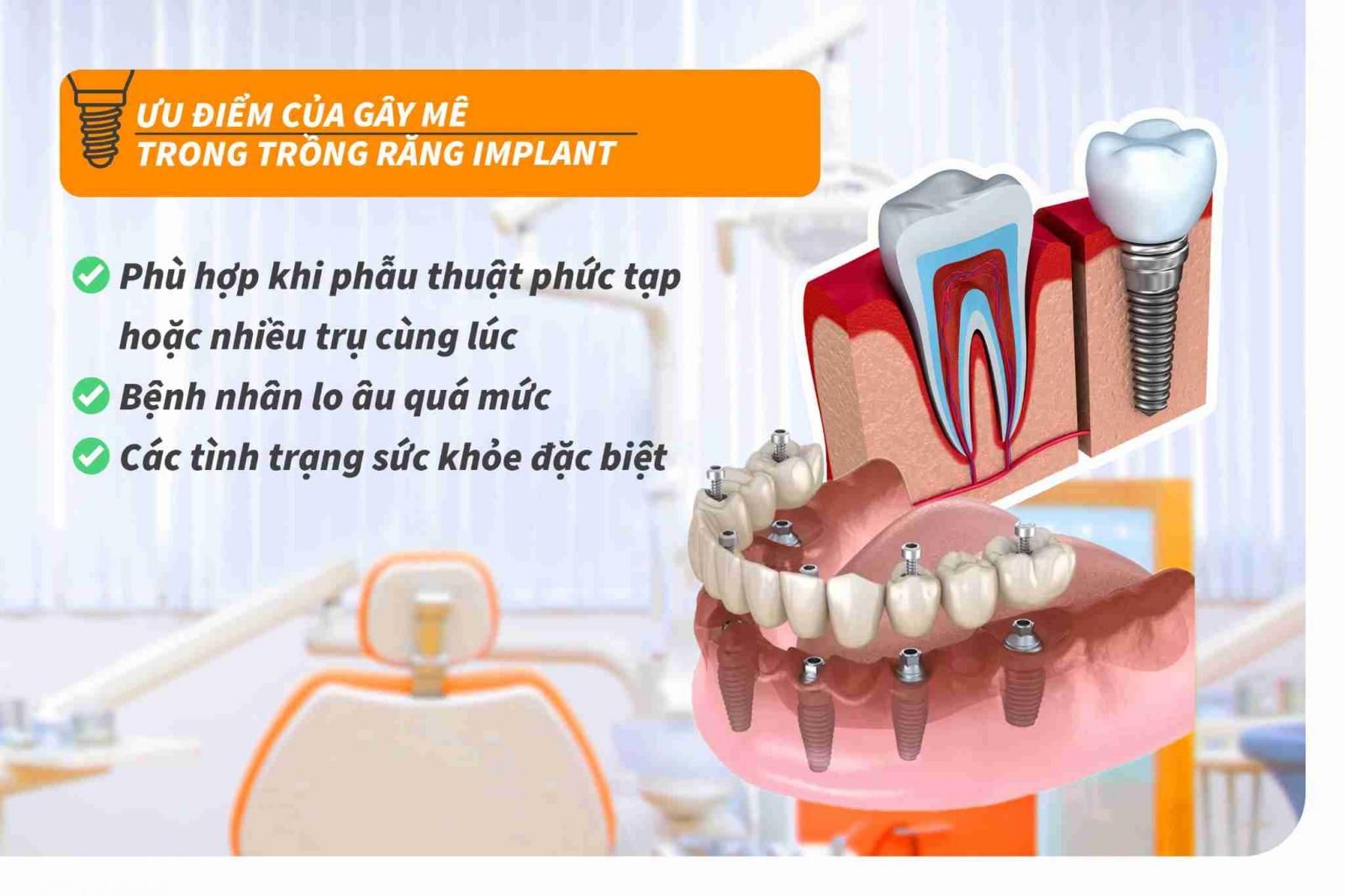 Ưu điểm của gây mê trong trồng răng Implant