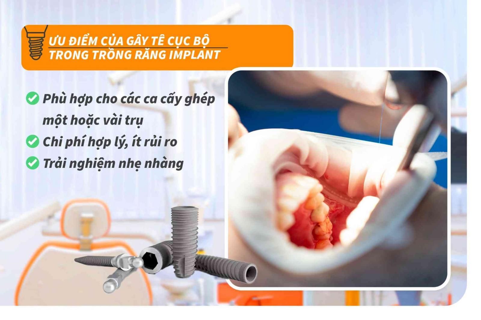 Ưu điểm của gây tê trong trồng răng Implant