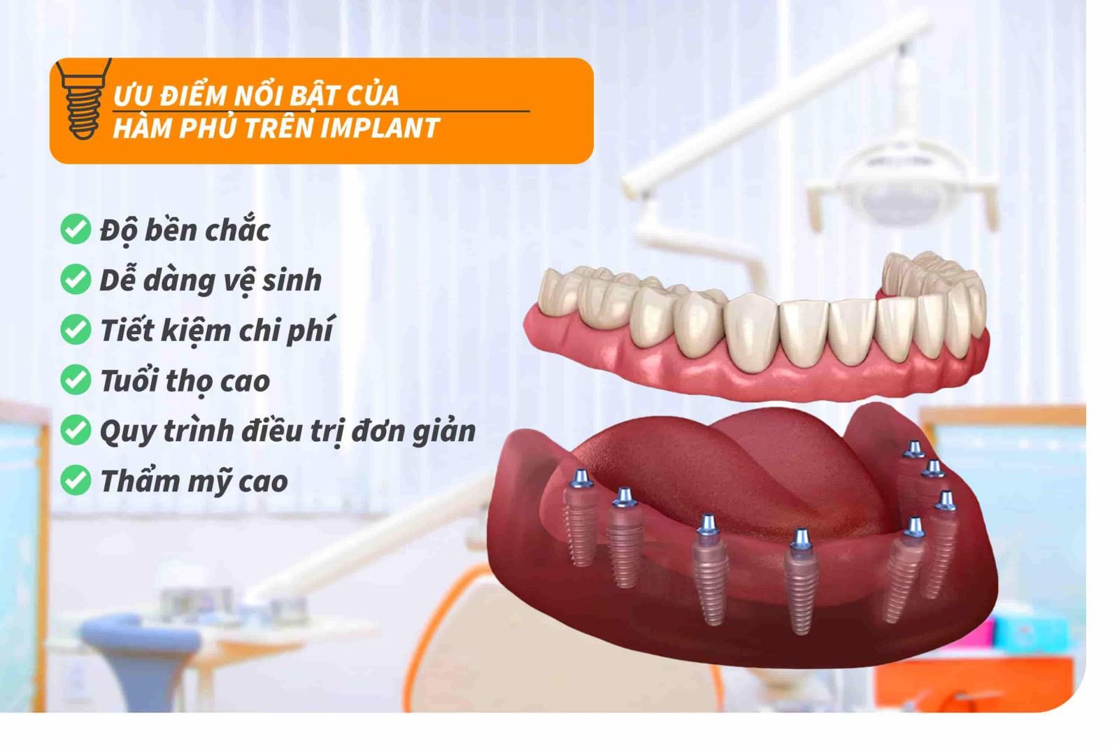 Ưu điểm nổi bật của hàm phủ trên Implant