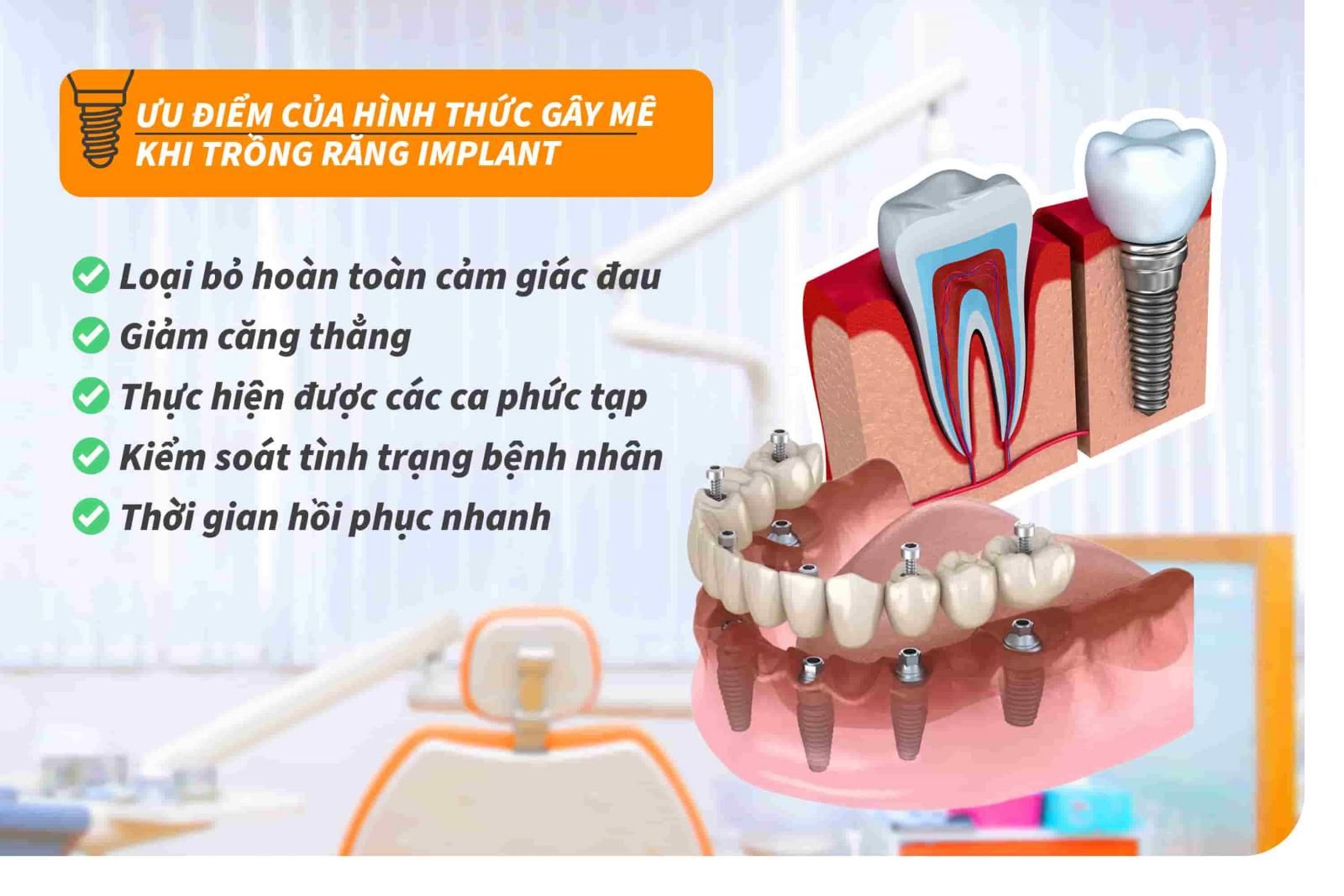 Ưu điểm của hình thức gây mê khi trồng răng Implant 