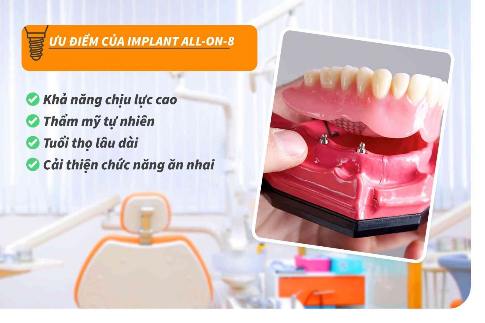 Ưu điểm của Implant All-on-8