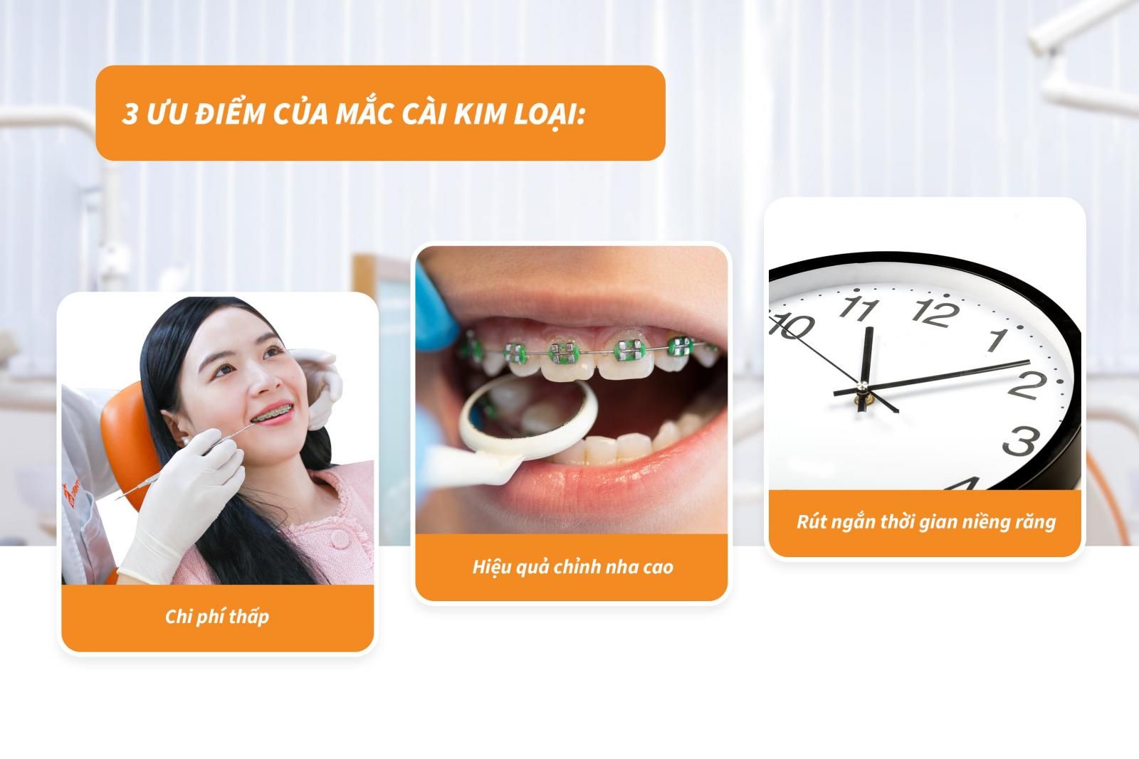 ưu điểm của mắc cài kim loại 