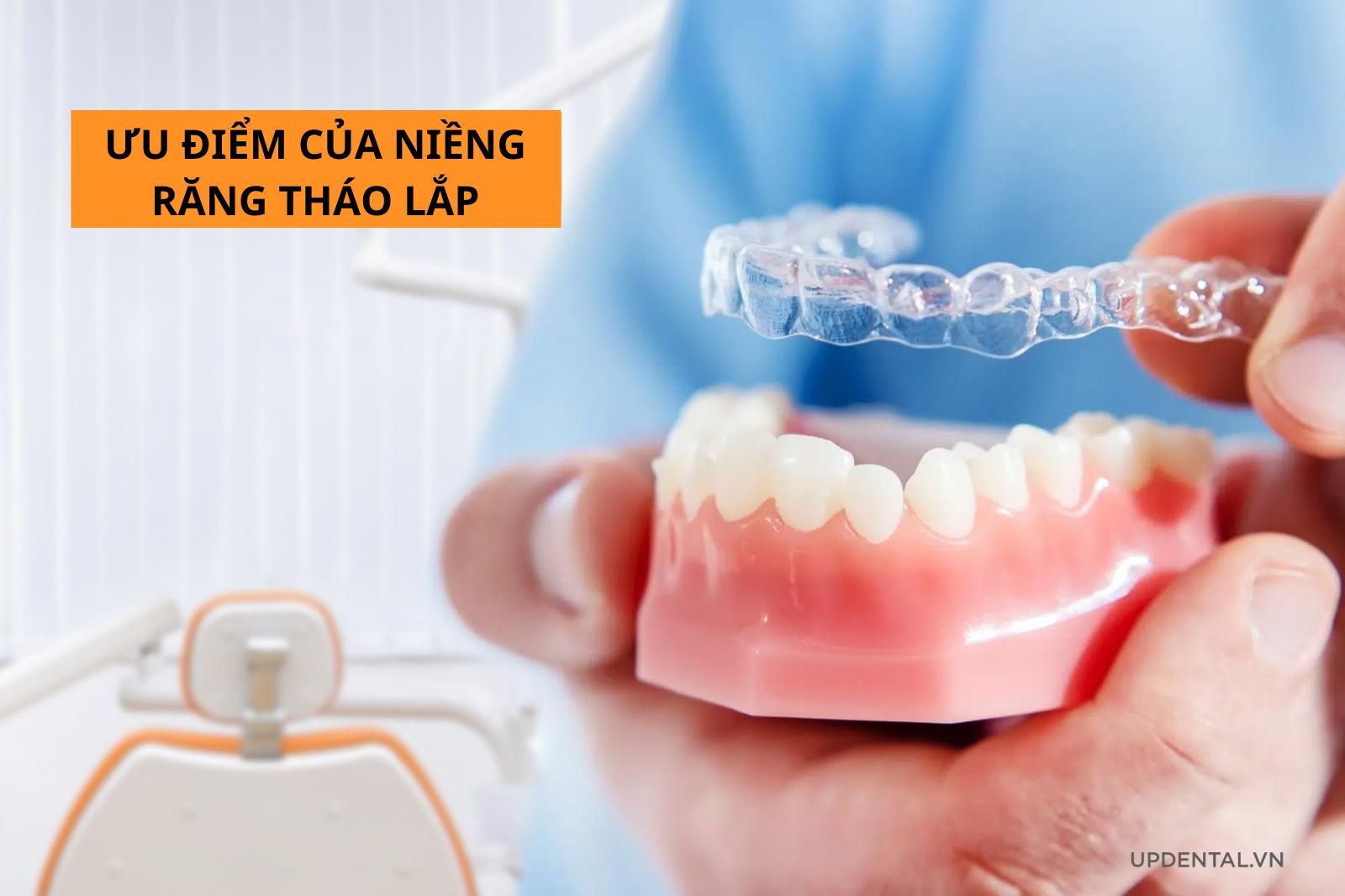 Ưu điểm của niềng răng tháo lắp