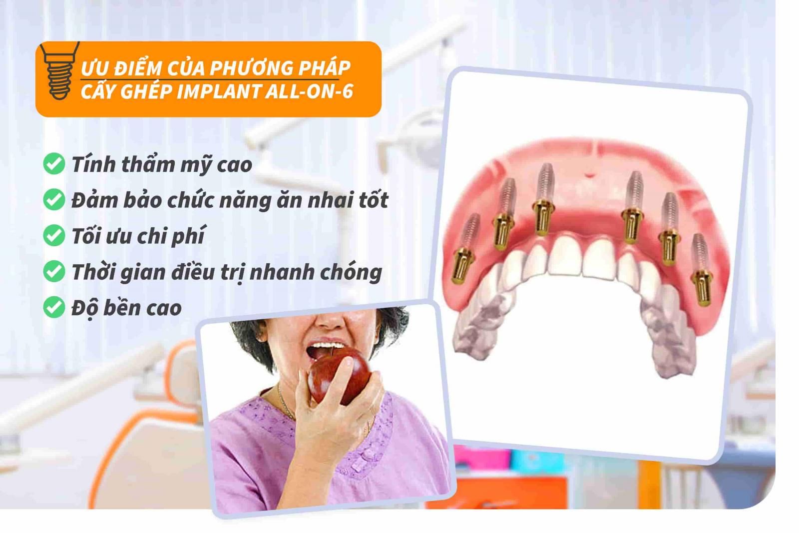 Ưu điểm của phương pháp cấy ghép Implant all-on-6