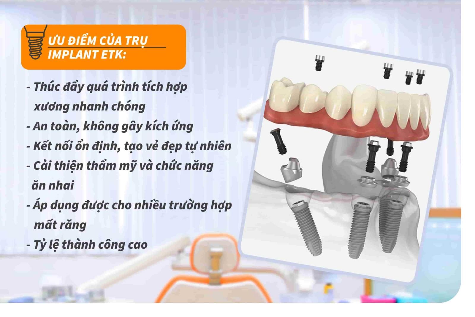 Ưu điểm của trụ Implant ETK