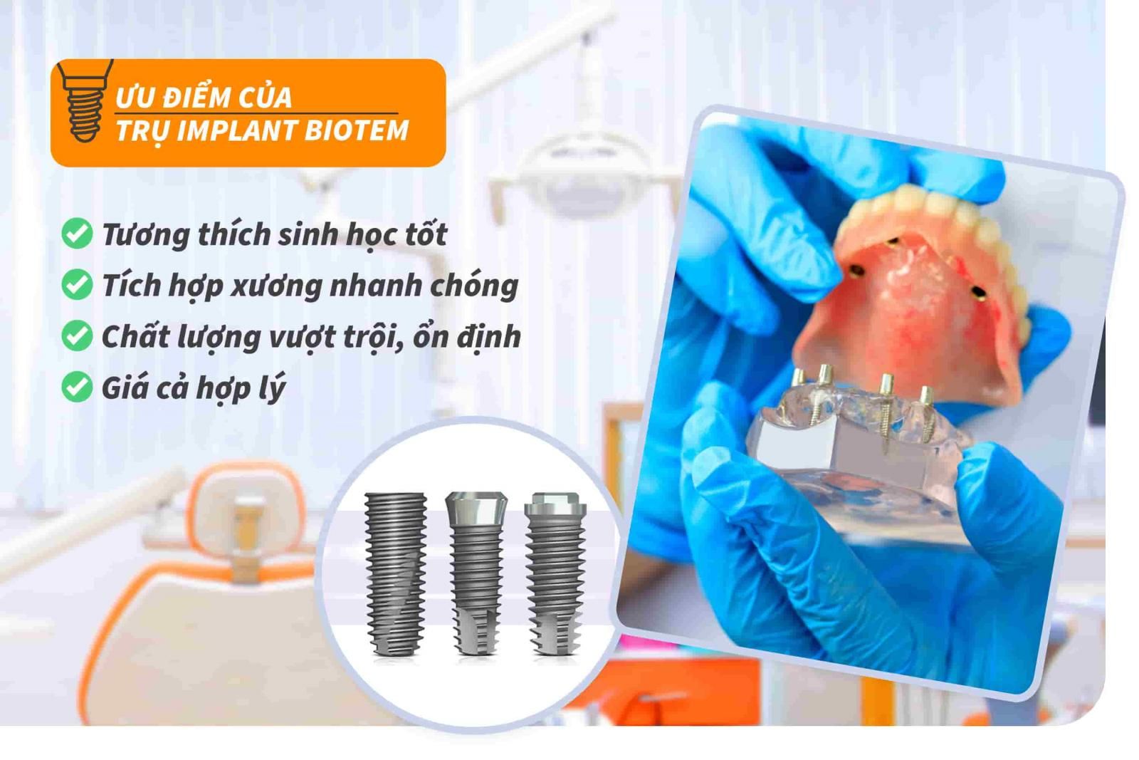 Ưu điểm của trụ Implant Biotem