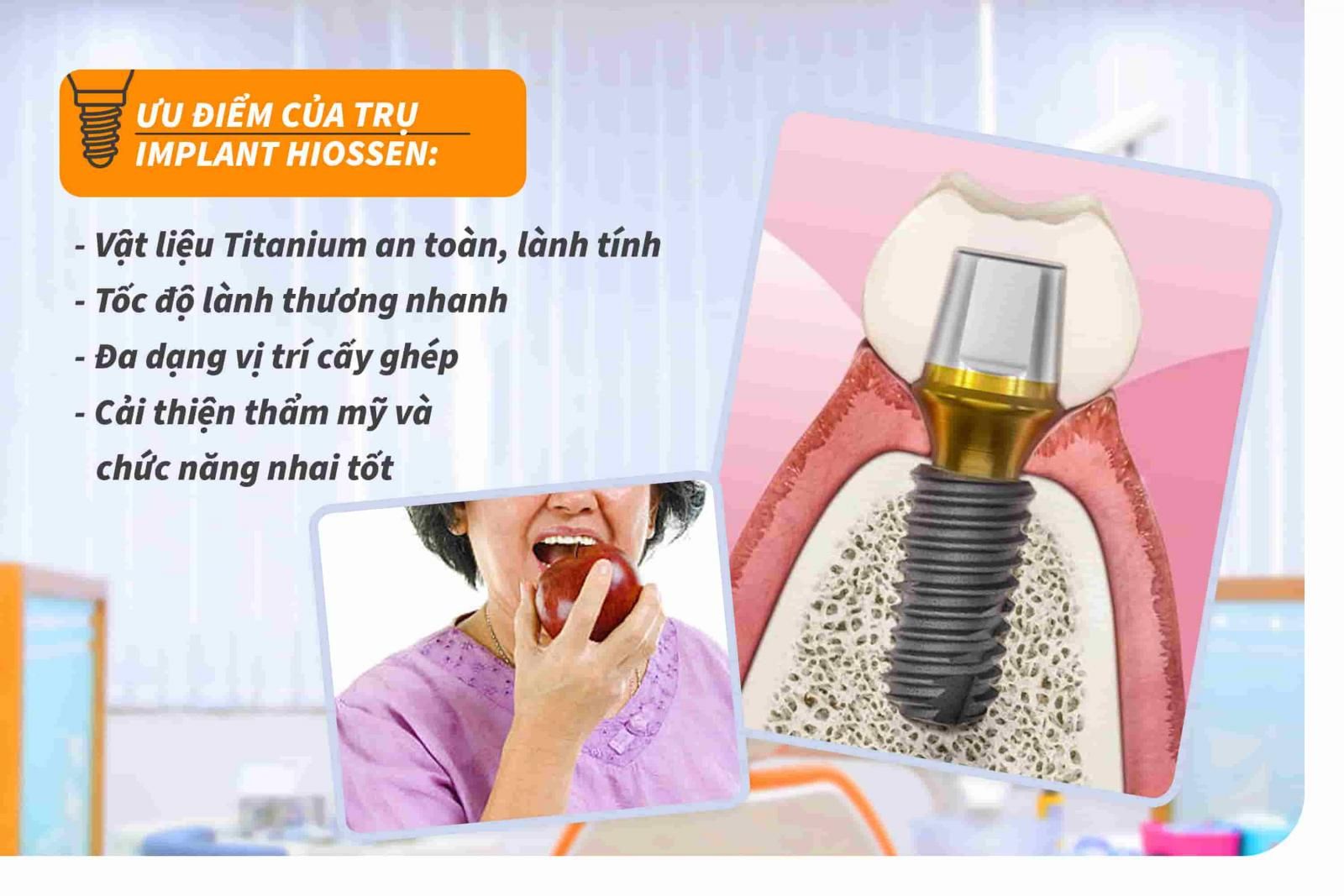 Ưu điểm của trụ Implant Hiossen