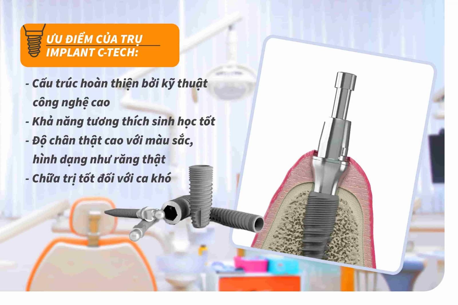 Ưu điểm của trụ Implant C-Tech