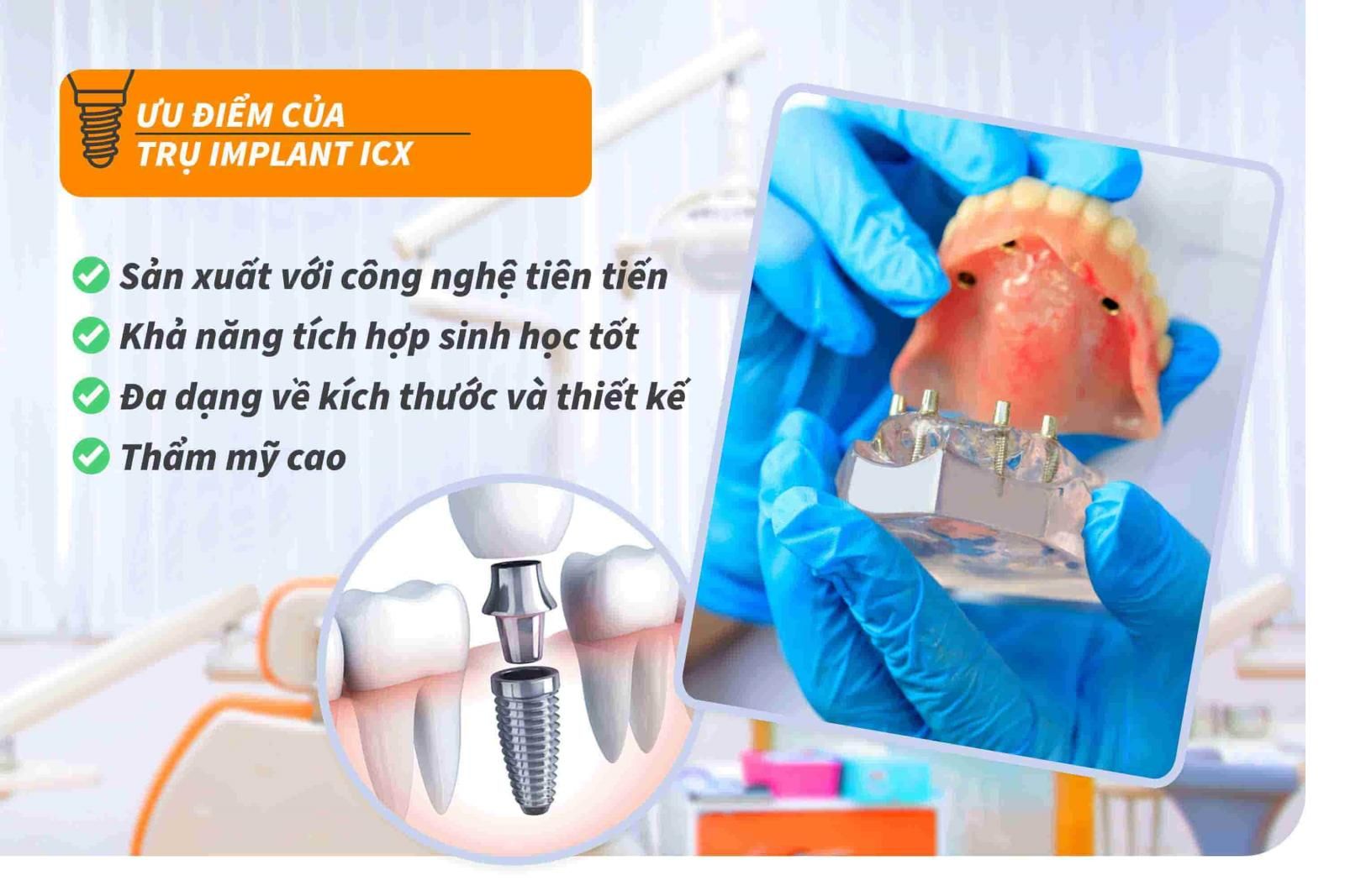 Ưu điểm của trụ Implant ICX