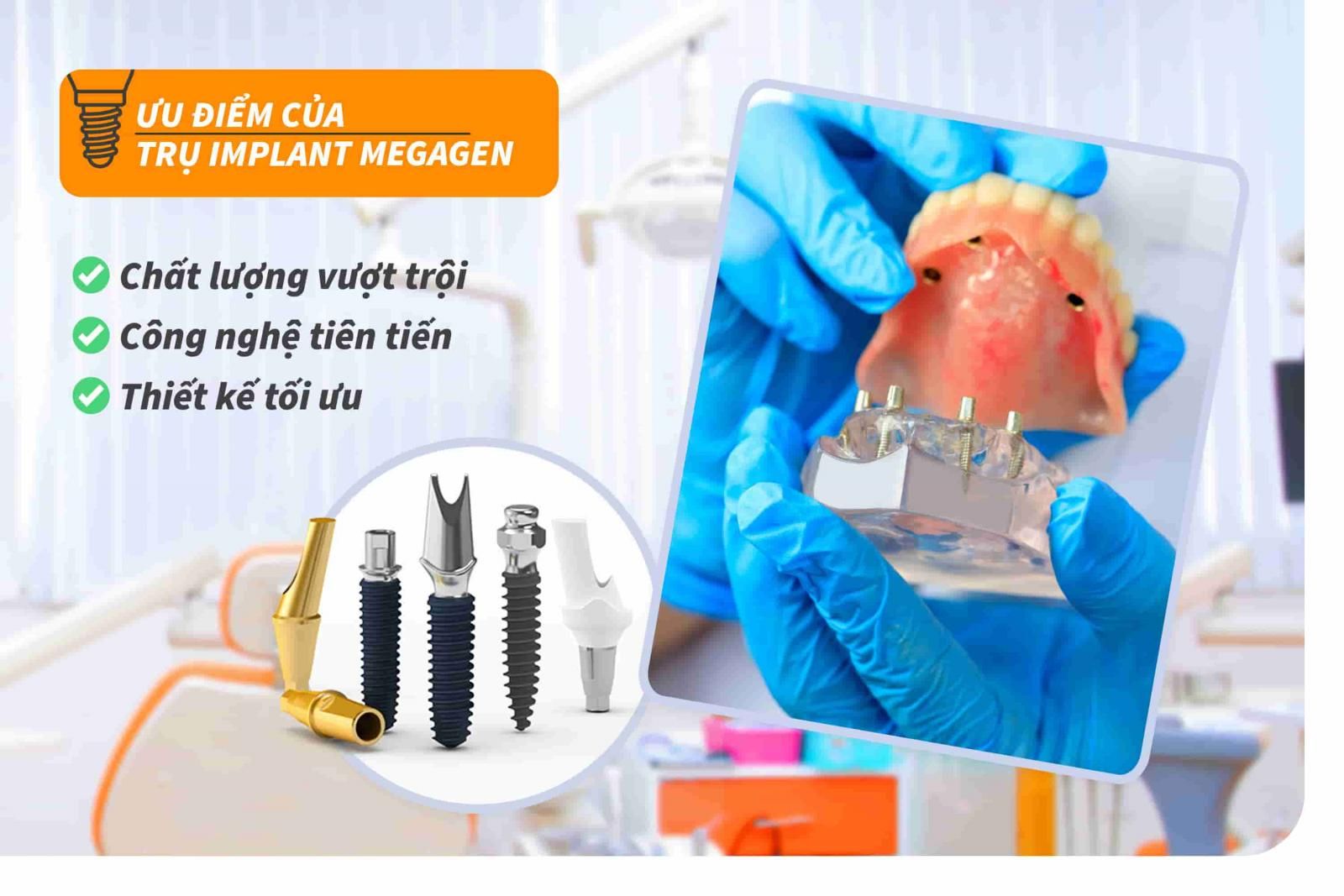 Ưu điểm của trụ Implant Megagen