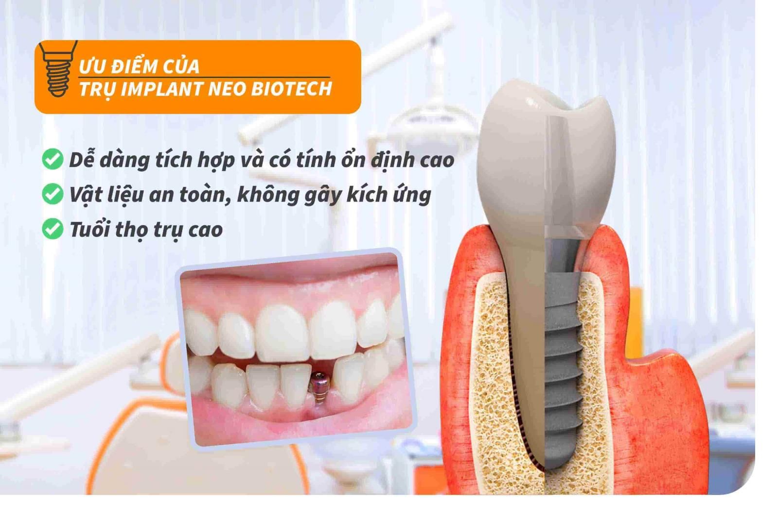 Ưu điểm của trụ Implant Neo Biotech