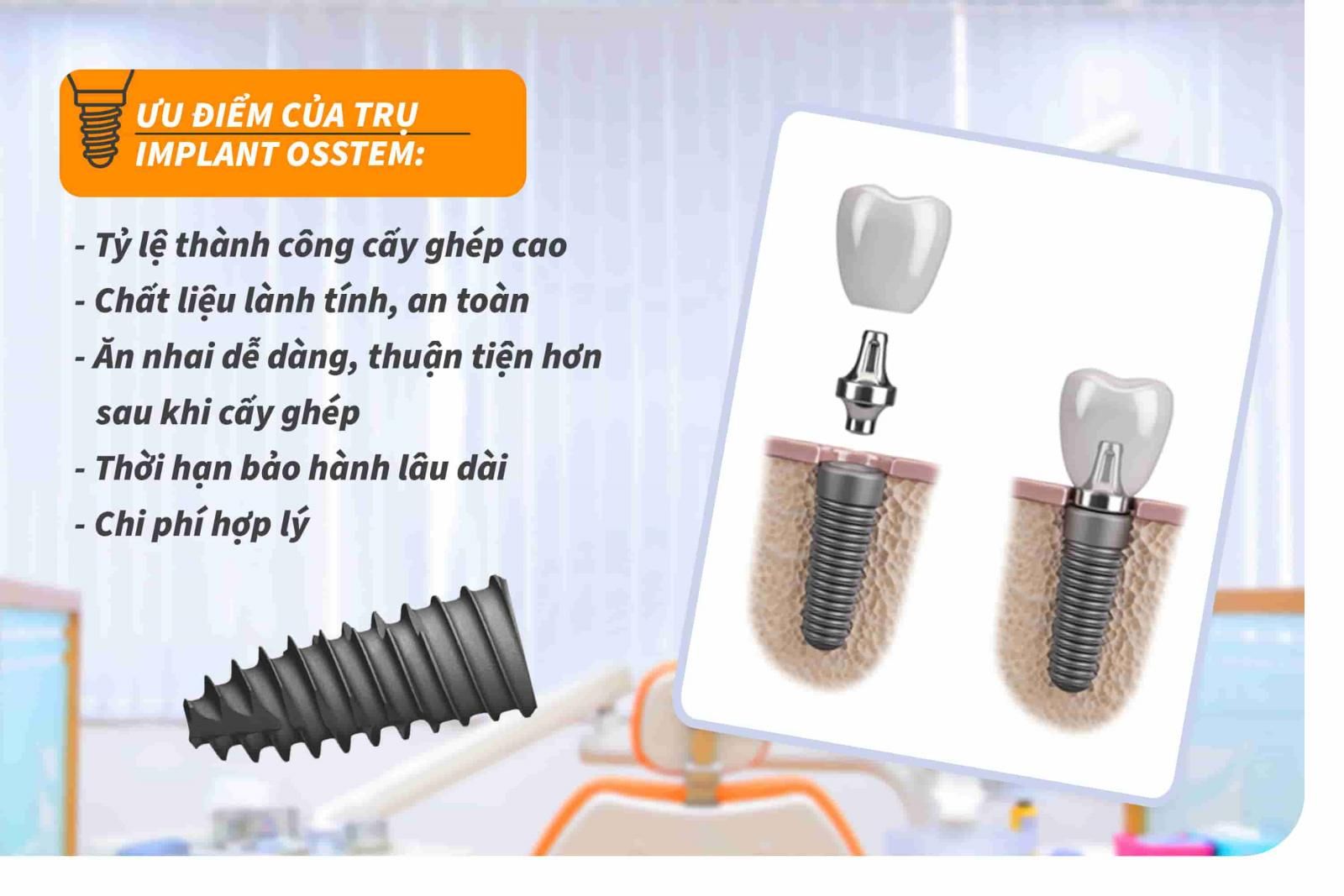 5 ưu điểm của trụ Implant Osstem