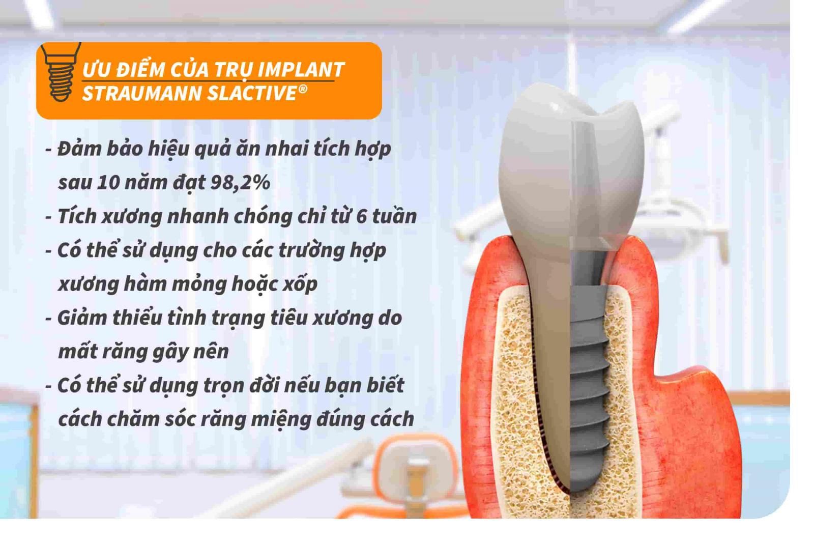 Ưu điểm của trụ Implant Straumann SLActive®