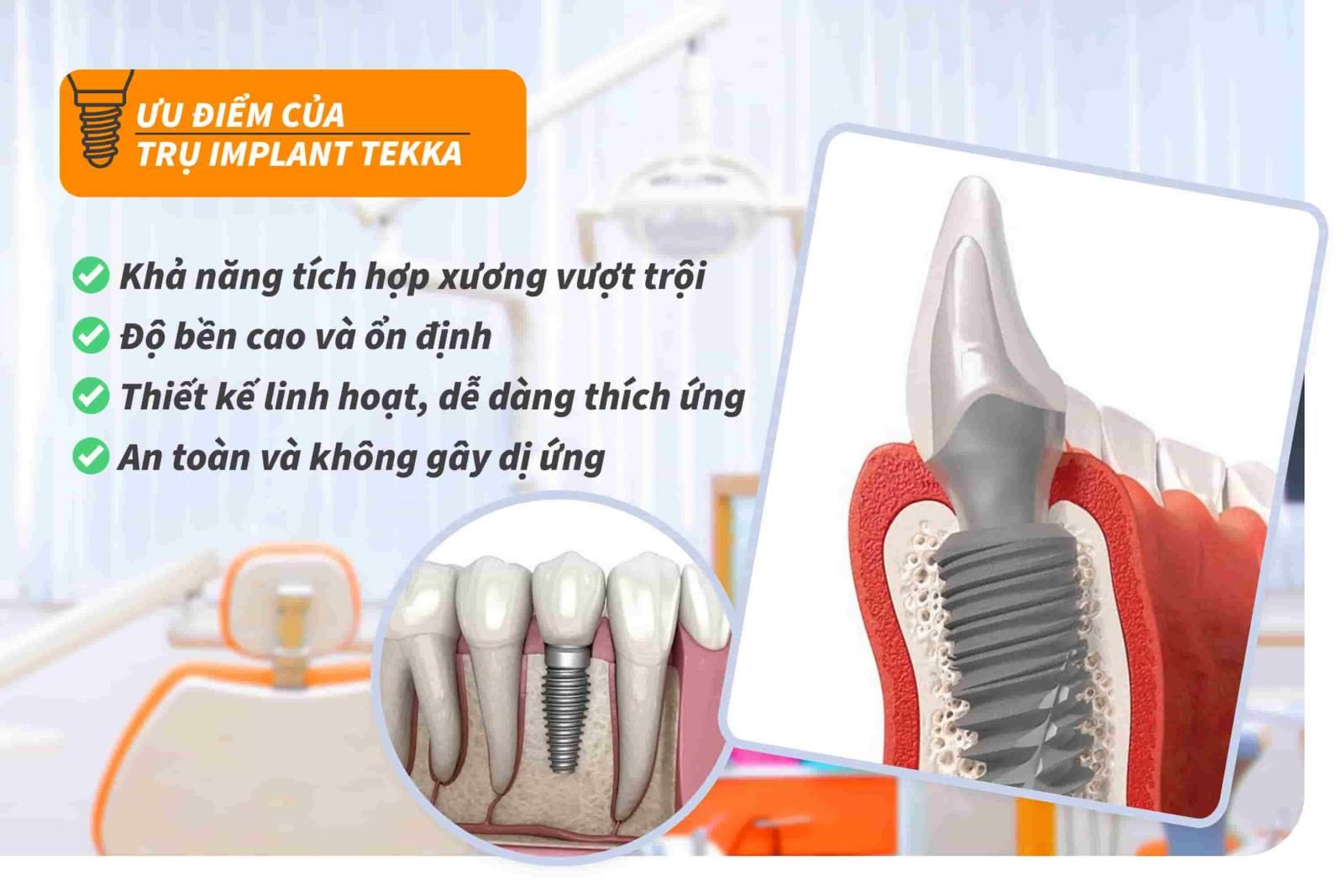 Ưu điểm của trụ Implant Tekka