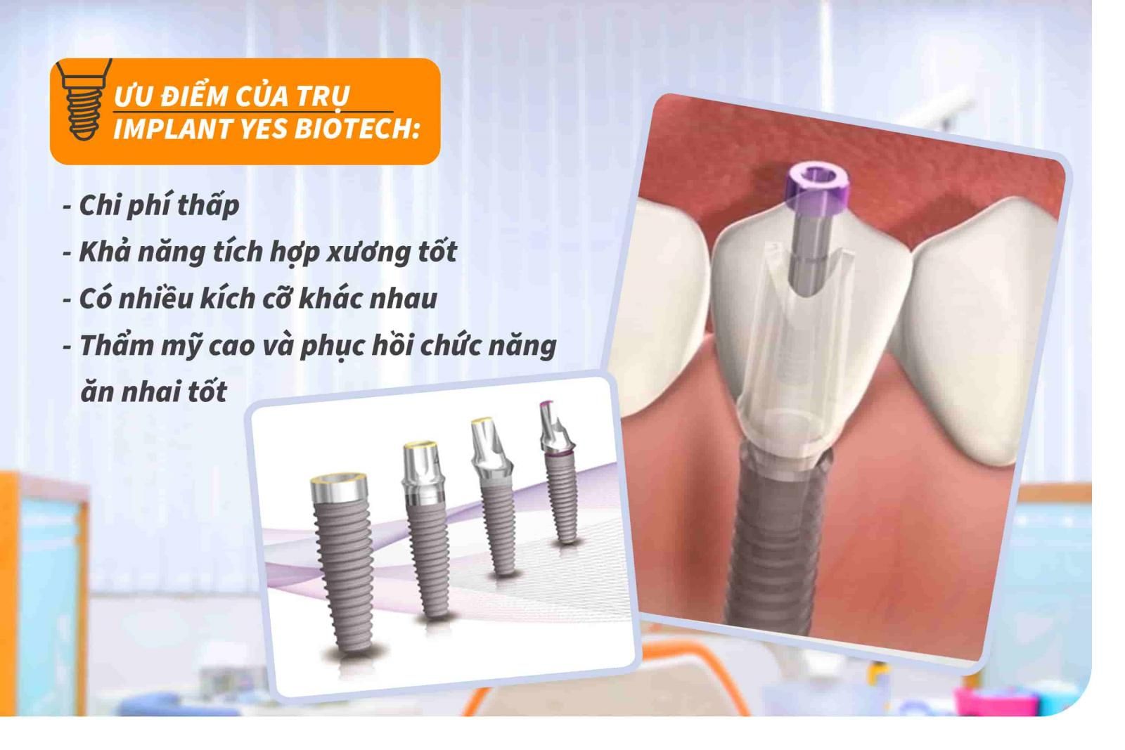 Ưu điểm của trụ Implant Yes Biotech