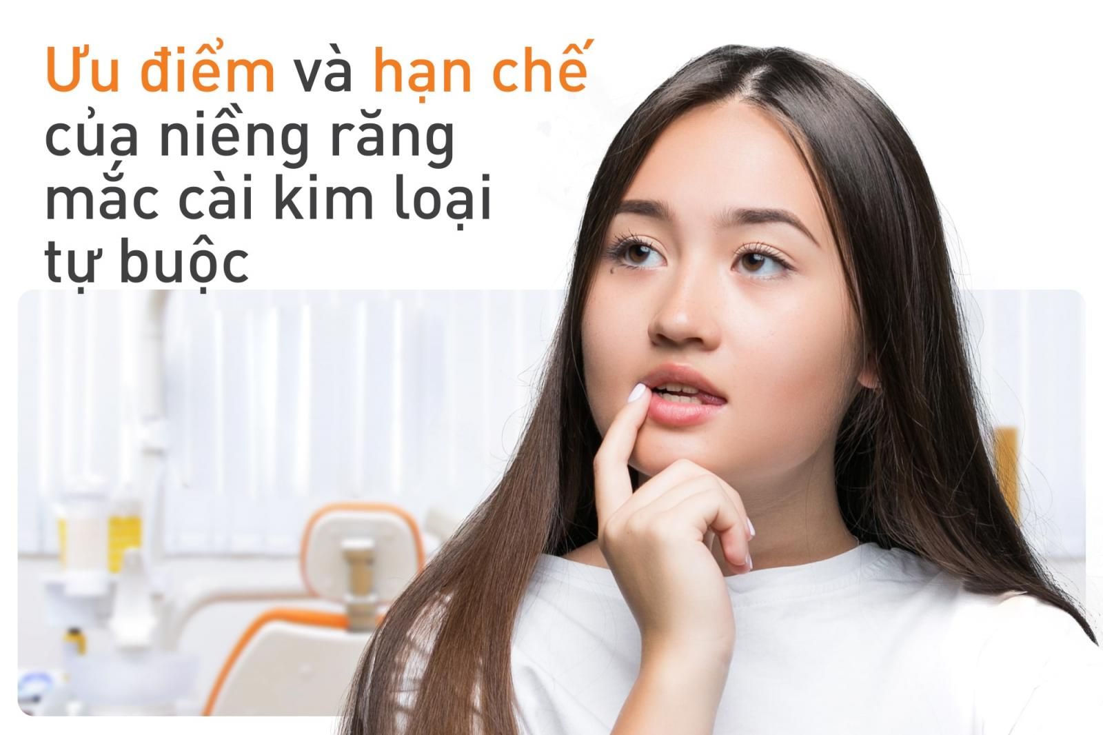 ưu điểm mắc cài tự buộc