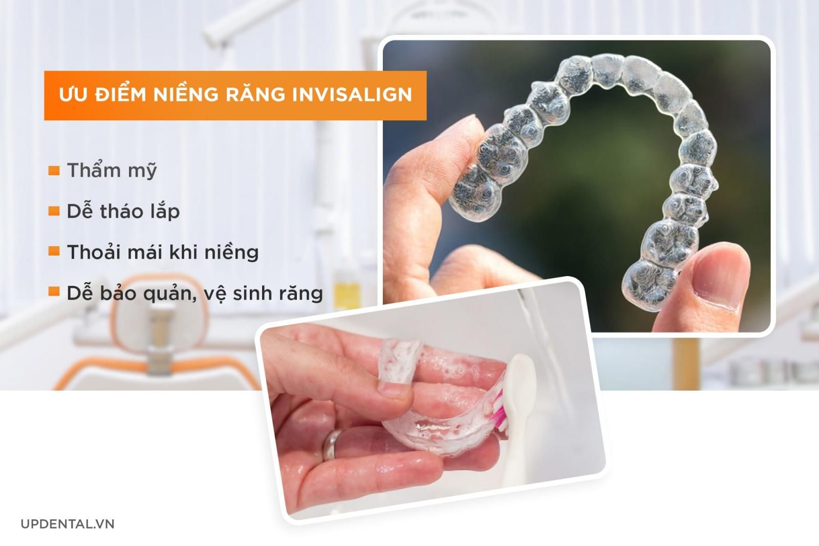 ưu điểm của niềng răng invisalign