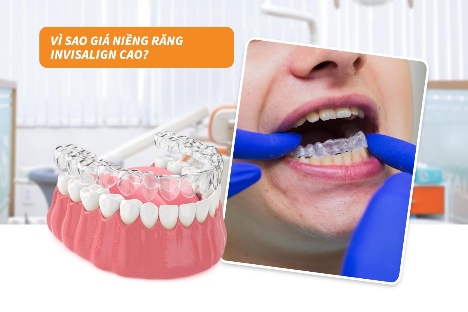 Vì sao giá niềng răng Invisalign lại cao?