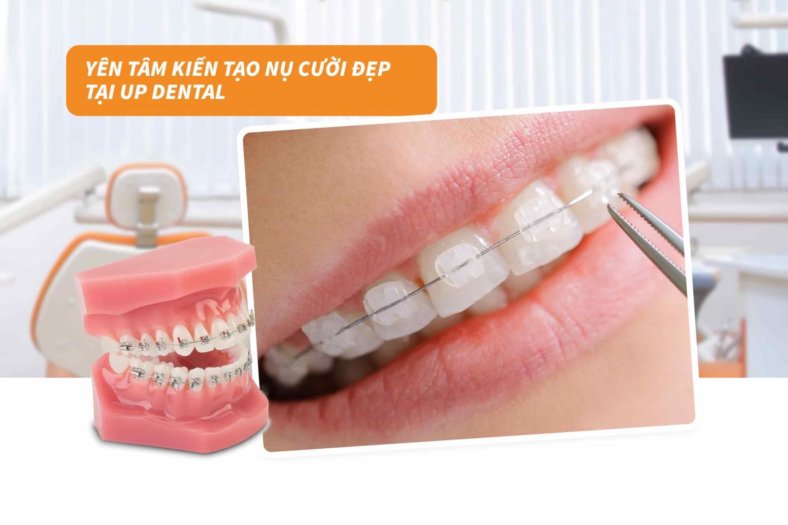 Yên tâm kiến tạo nụ cười đẹp tại Up Dental 