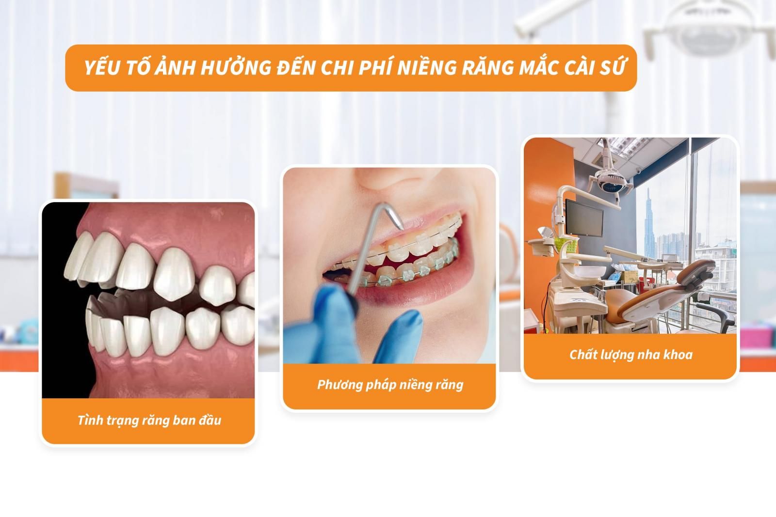 Yếu tố ảnh hưởng đến chi phí niềng răng mắc cài sứ