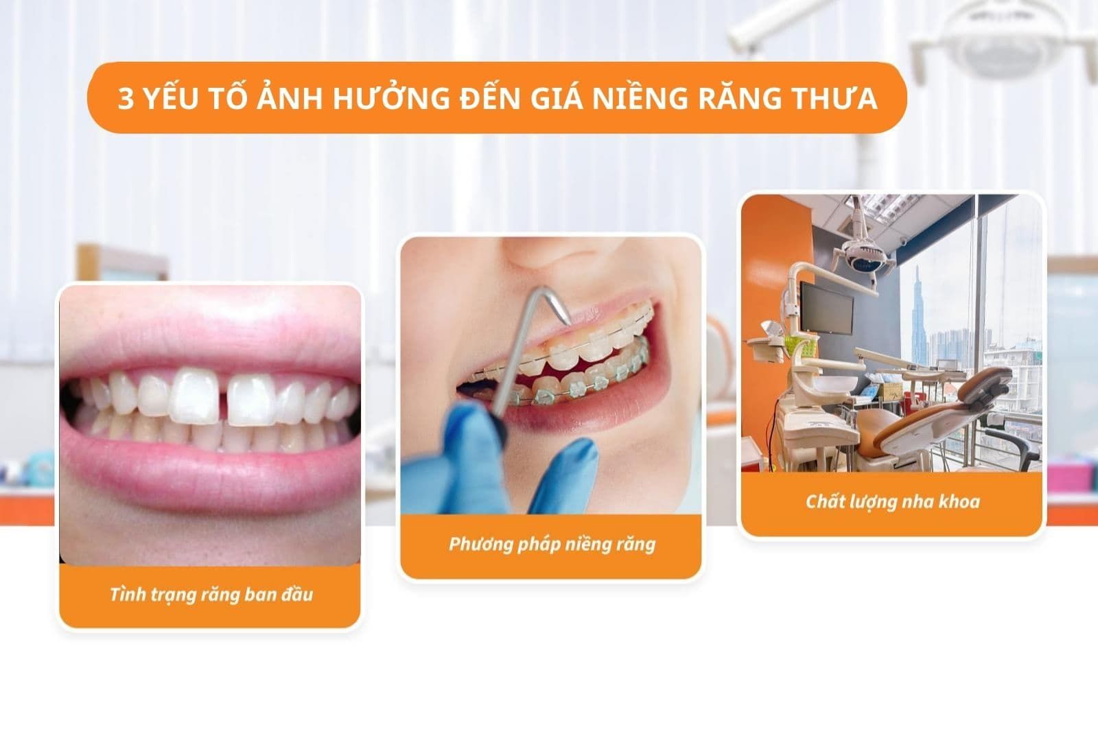 3 yếu tố ảnh hưởng đến giá niềng răng thưa