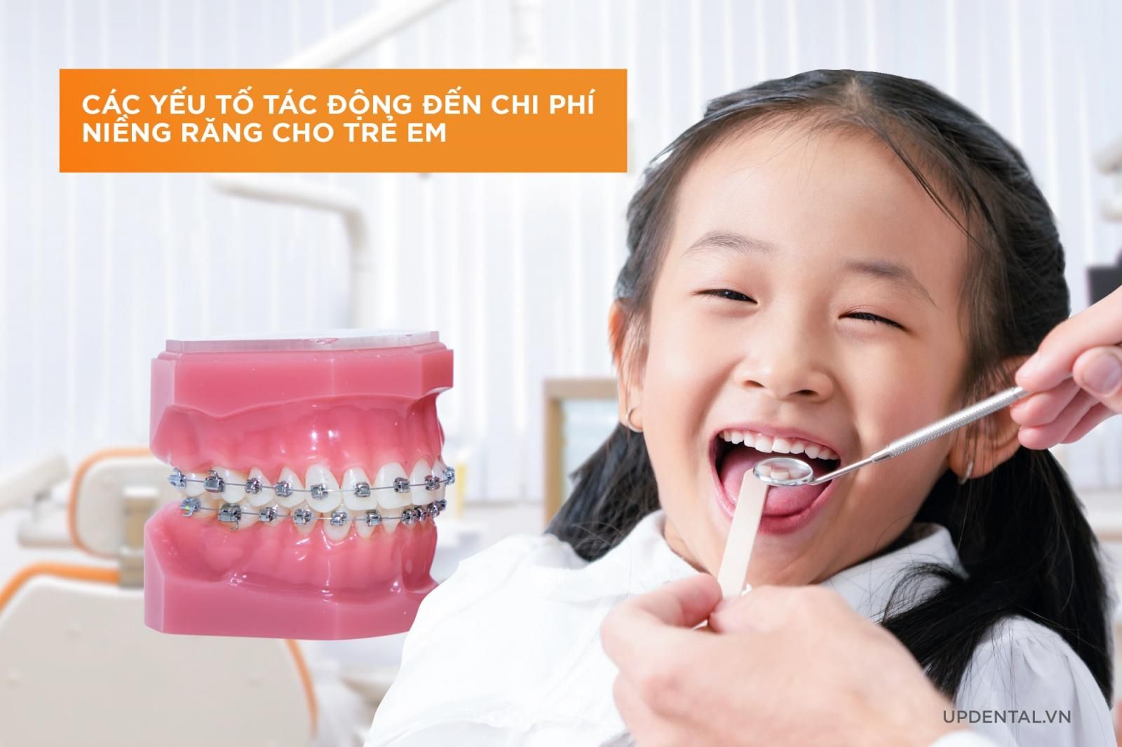 Yếu tố ảnh hưởng đến chi phí niềng răng